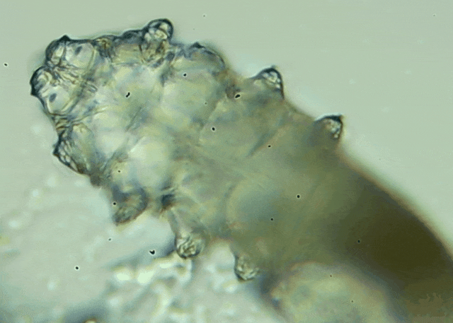 睫毛上驚現(xiàn)80只螨蟲！別揉了，快自查下你的眼睛有沒有......